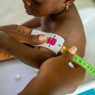 Strategie per prevenire la malnutrizione negli anziani - nutrizione geriatria